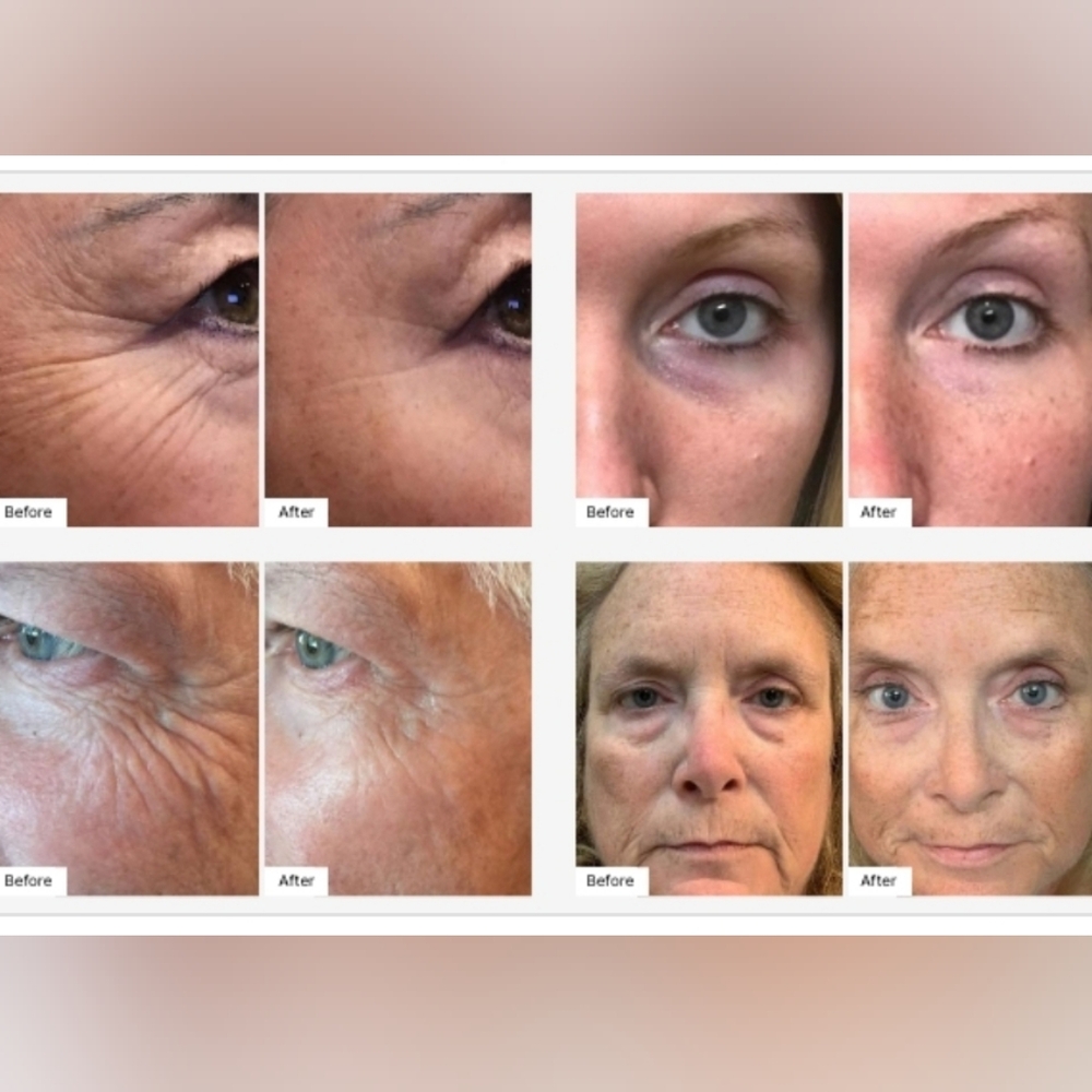 Eye Serum - Picture 2 of 8